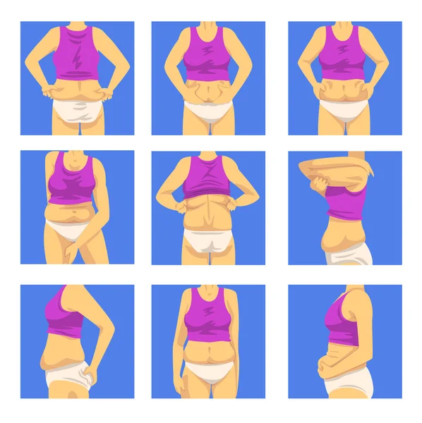 En del av kvinnlig övervikt kropps uppsättning, mänsklig figur efter viktminskning, främre, rygg och sida Visa, fetma och ohälsosamma äta problem vektor illustration — Stock vektor
