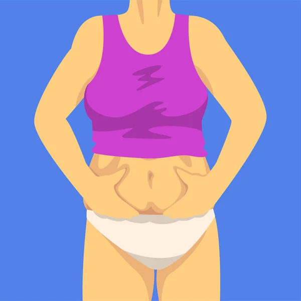 Μέρος του γυναικείου σώματος, γυναίκα σύσφιξης Δίπλωση της κοιλιάς με τα χέρια της, μπροστινή όψη, ανθρώπινη φιγούρα μετά την απώλεια βάρους, την παχυσαρκία και τα ανθυγιεινά προβλήματα διατροφής απεικόνιση διάνυσμα — Διανυσματικό Αρχείο