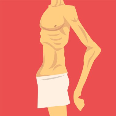 Male Torso with Short Weight and Sagging Belly, Human Body After Weight Loss, Side View, Obesity and Unhealthy Eating Problems Vector Illustration clipart