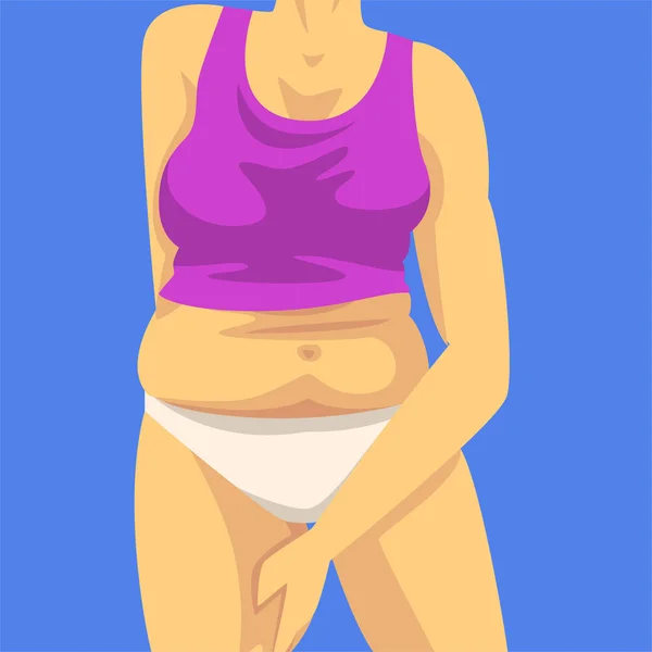 Deel van vrouwelijk lichaam met dikke buik, vrouw span vouw van hip met haar hand, menselijke figuur na gewichtsverlies, obesitas en ongezonde eten problemen vector illustratie — Stockvector