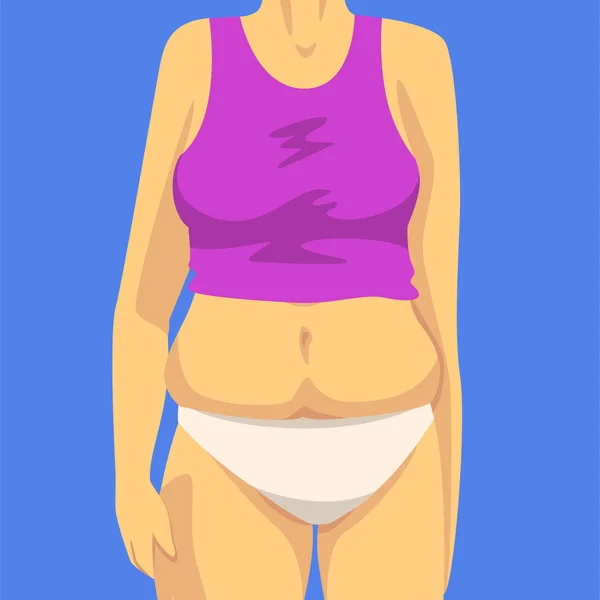Parte del corpo femminile con pancia grassa, figura umana dopo la perdita di peso, vista frontale, obesità e problemi alimentari malsani Illustrazione vettoriale — Vettoriale Stock