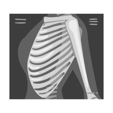X-ray Film of Ribs Vector Illustrated Image for Educational Purpose clipart