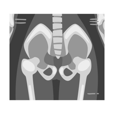 Coxofemoral Ortak Görünüm Vektör Resimli Eğitim Amaçlı Görüntü X-ray Filmi