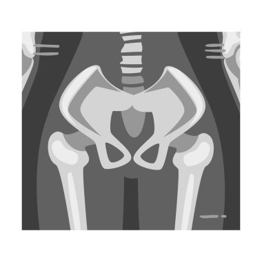 X-ray Film of Coxofemoral Joint Back View Vector Illustrated Image for Educational Purpose clipart