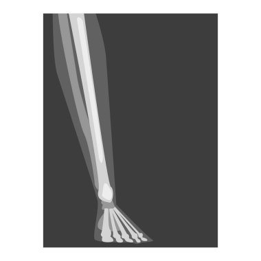 Roentgenograph of Lower Leg Front View Vector Image clipart