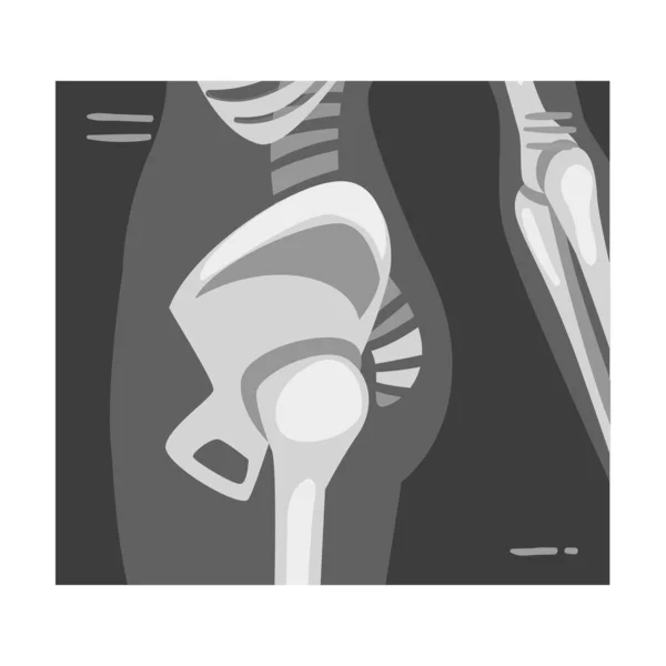 X-ray Film of Coxofemoral Joint Side View Vector Illustrated Image for Educational Purpose — Stock Vector