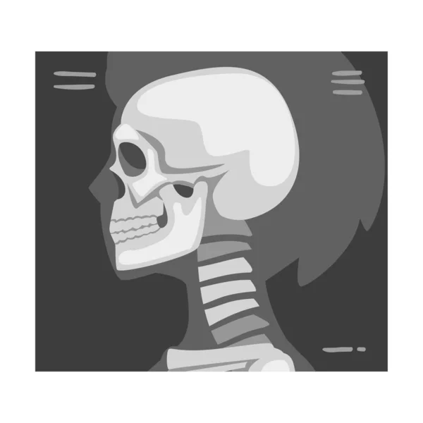 Roentgénographe de crâne vue de côté Image vectorielle — Image vectorielle