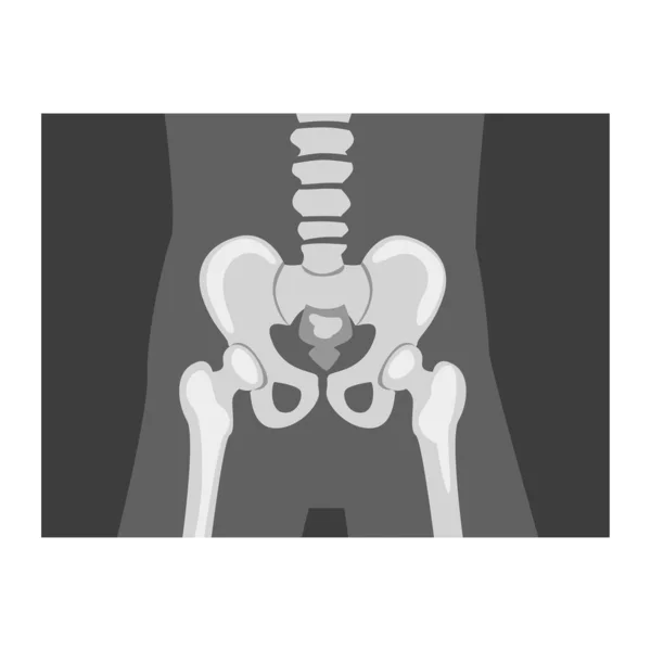 Roentgenograph of Coxofemoral Joint Front View Vector Image — Image vectorielle