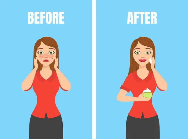 Girl with Acne Before and After Skin Treatment, Skin Care, Pure and Healthy Skin Vector Illustration - Stok Vektor