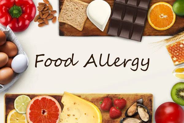 Zestaw żywności alergiczne z czarnym tekstem — Zdjęcie stockowe