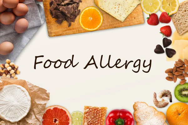 Conjunto de alimentos alérgicos con texto negro — Foto de Stock