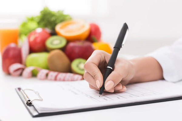 Nutritionist doctor writing diet plan on table