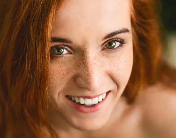 Mujer pelirroja alegre con pecas riendo de la cámara — Foto de Stock