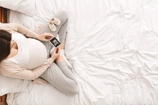 Pregnant woman looking at her baby sonography — Stock Photo, Image