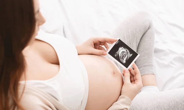 Mujer embarazada disfrutando de su imagen de ultrasonido bebé — Foto de Stock