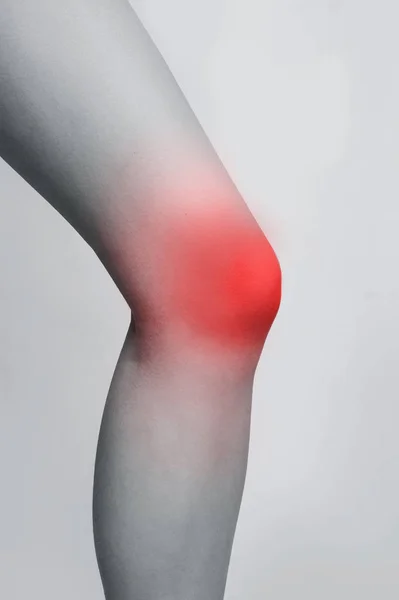 Жіноча нога з червоною зоною травмованого коліна — стокове фото