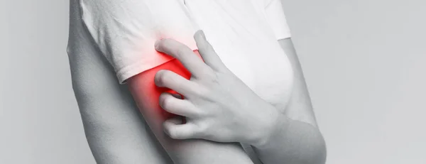 Woman scratching her shoulder with red rash — 스톡 사진