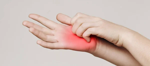 Woman scratching her itchy palm with rash — Stock Photo, Image