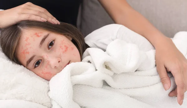 Fille avec le virus de la rougeole couché sur les genoux mère — Photo