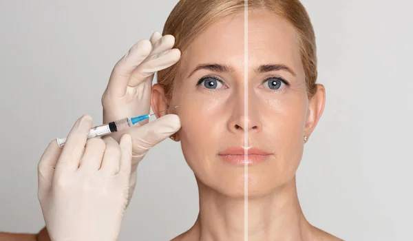 Inyección para mujeres mayores con jeringa para ambas partes de la cara — Foto de Stock