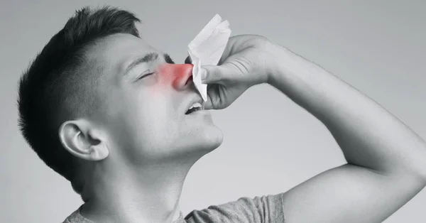 Homem jovem que sofre de sangramento nasal, pare o sangue com tecido — Fotografia de Stock