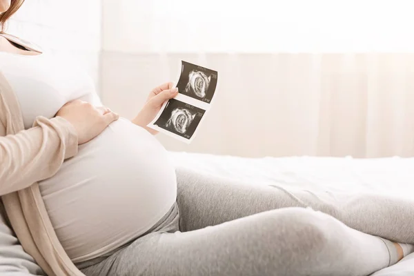 Mujer embarazada sosteniendo ultrasonido foto del bebé y acariciando su vientre —  Fotos de Stock