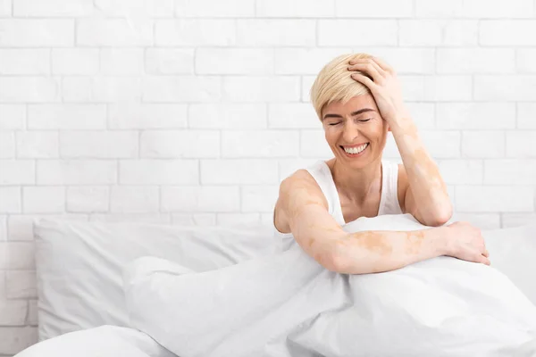 Frau mittleren Alters mit Vitiligo lacht im Bett — Stockfoto