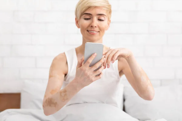 Mature woman with vitiligo networking on cellphone in bed