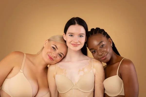 Portrait Of Three Multiracial Woman With Different Skin Type And Body Weight — Stock Photo, Image