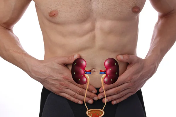 Male Urinary Tract Infection Problems — Stock Photo, Image