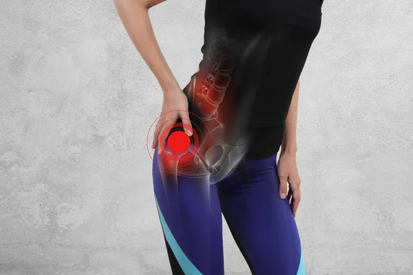 Woman Hip Joint Pain Sport Exercising Injury — Stock Photo, Image