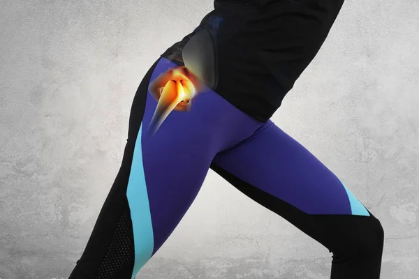 Mulher Com Dor Nas Articulações Quadril Esporte Exercendo Lesão — Fotografia de Stock