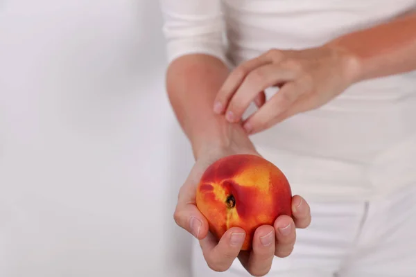 Woman Suffering Fruit Allergy Holding Peach Oas Food Allergy Symptoms — Stock Photo, Image