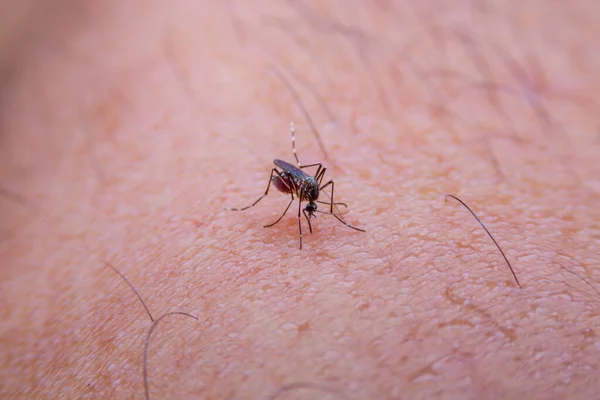 Los Mosquitos Rayados Están Comiendo Sangre Piel Humana Mordedura Piel —  Fotos de Stock