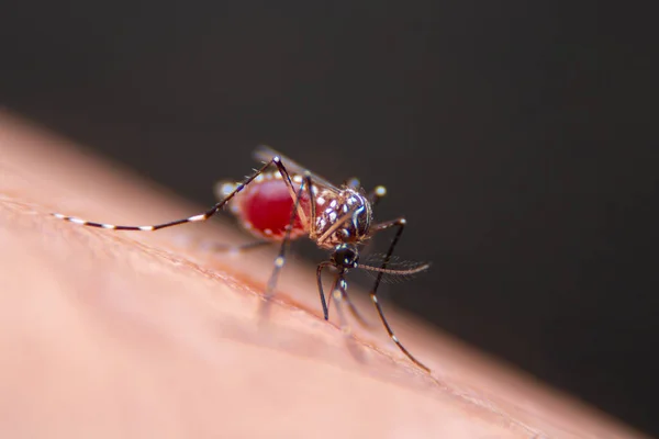 Zanzare Strisce Stanno Mangiando Sangue Sulla Pelle Umana Malaria Pericolosa — Foto Stock