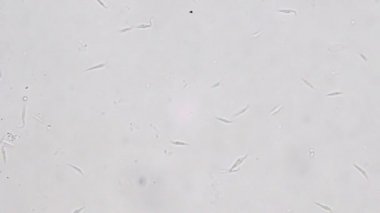 Trypanosoma cruzi mikroskop görünümü; insan hastalıkları
