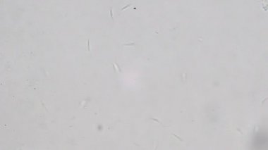 Trypanosoma cruzi mikroskop görünümü; insan hastalıkları