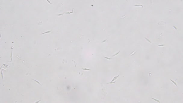 Visão microscópica de Trypanosoma cruzi; doenças humanas — Vídeo de Stock