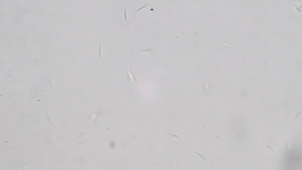 Trypanosoma cruzi Mikroskop Ansicht; menschliche Krankheiten — Stockvideo