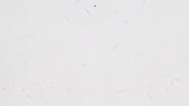 Trypanosoma cruzi mikroskop görünümü; insan öldüren Chagas hastalığının ajan
