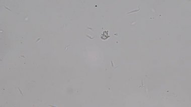 Trypanosoma cruzi mikroskop görünümü; insan öldüren Chagas hastalığının ajan