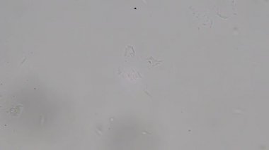 Trypanosoma cruzi mikroskop görünümü; insan öldüren Chagas hastalığının ajan