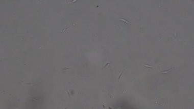 Trypanosoma cruzi mikroskop görünümü; insan öldüren Chagas hastalığının ajan