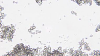 Trypanosoma cruzi mikroskop görünümü; insan hastalıkları