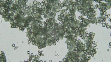 Trypanosoma cruzi mikroskop görünümü; insan hastalıkları