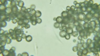 Trypanosoma cruzi mikroskop görünümü; insan hastalıkları