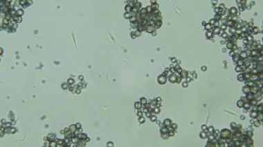 Trypanosoma cruzi mikroskop görünümü; insan hastalıkları