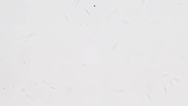 トリパノノーマクルジ顕微鏡ビュー 人間殺害シャーガス病のエージェント — ストック動画