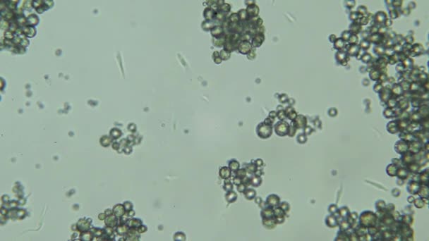 Vista microscopio tripanosoma cruzi; malattie umane — Video Stock