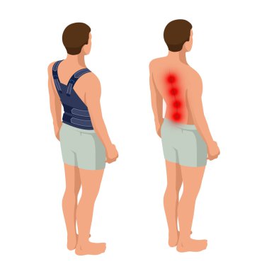 Alt sırt ağrısı veya omurga ağrısı, osteoporoz. Anatomik vücut bir adam. Travma sonrası rehabilitasyon. Ortopedi ve Tıp. İzometrik vektör çizim